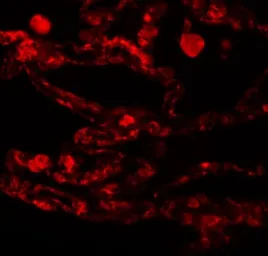 Anti-CCDC69 antibody used in IHC (Paraffin sections) (IHC-P). GTX85190