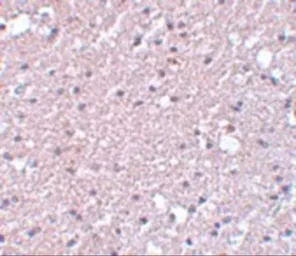 Anti-TMEM184A antibody used in IHC (Paraffin sections) (IHC-P). GTX85194