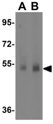 Anti-TMEM184A antibody used in Western Blot (WB). GTX85194