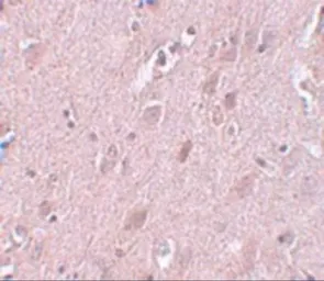 Anti-ZC3H12B antibody used in IHC (Paraffin sections) (IHC-P). GTX85196