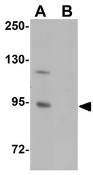 Anti-ZC3H12B antibody used in Western Blot (WB). GTX85196