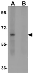 Anti-LYRM2 antibody used in Western Blot (WB). GTX85197