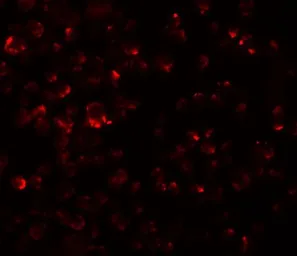 Anti-LYRM2 antibody used in Immunocytochemistry/ Immunofluorescence (ICC/IF). GTX85197