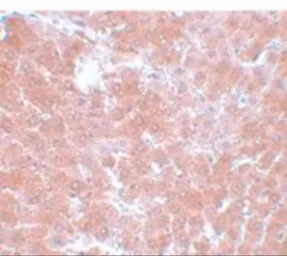 Anti-TMEM70 antibody used in IHC (Paraffin sections) (IHC-P). GTX85199