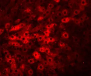Anti-TMEM70 antibody used in IHC (Paraffin sections) (IHC-P). GTX85199