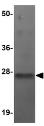 Anti-TMEM70 antibody used in Western Blot (WB). GTX85199
