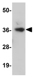 Anti-LRRC19 antibody used in Western Blot (WB). GTX85200
