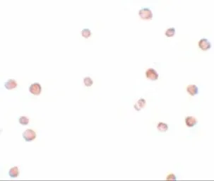 Anti-LRRC19 antibody used in Immunocytochemistry/ Immunofluorescence (ICC/IF). GTX85200
