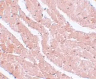 Anti-MTUS2 antibody used in IHC (Paraffin sections) (IHC-P). GTX85202