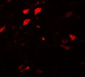 Anti-DCLK3 antibody used in IHC (Paraffin sections) (IHC-P). GTX85203