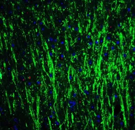 Anti-DCLK3 antibody used in IHC (Paraffin sections) (IHC-P). GTX85203