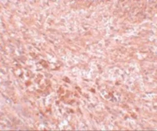 Anti-LZTR2 antibody used in IHC (Paraffin sections) (IHC-P). GTX85204