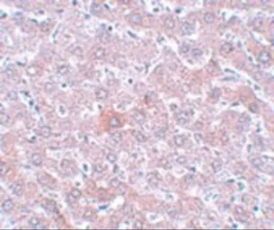 Anti-RSRC1 antibody used in IHC (Paraffin sections) (IHC-P). GTX85206