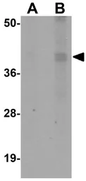 Anti-CALHM1 antibody used in Western Blot (WB). GTX85207