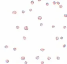 Anti-ARHGAP18 antibody used in Immunocytochemistry/ Immunofluorescence (ICC/IF). GTX85208
