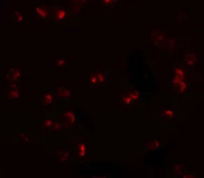 Anti-CHORDC1 antibody used in Immunocytochemistry/ Immunofluorescence (ICC/IF). GTX85209