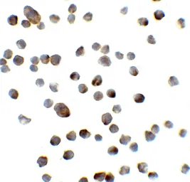 Anti-REEP3 antibody used in Immunocytochemistry/ Immunofluorescence (ICC/IF). GTX85210