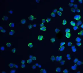 Anti-REEP3 antibody used in Immunocytochemistry/ Immunofluorescence (ICC/IF). GTX85210