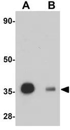 Anti-REEP3 antibody used in Western Blot (WB). GTX85210
