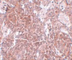 Anti-TSPAN9 antibody used in IHC (Paraffin sections) (IHC-P). GTX85211