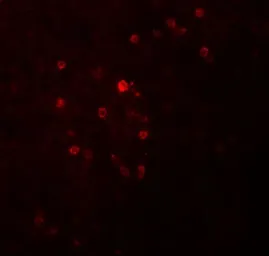 Anti-TSPAN9 antibody used in IHC (Paraffin sections) (IHC-P). GTX85211