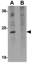 Anti-TSPAN9 antibody used in Western Blot (WB). GTX85211