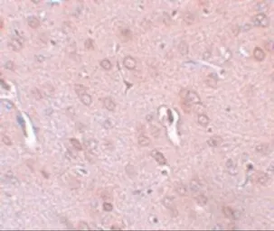 Anti-TRESK antibody used in IHC (Paraffin sections) (IHC-P). GTX85212