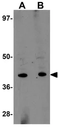 Anti-TRESK antibody used in Western Blot (WB). GTX85212