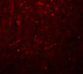 Anti-TRESK antibody used in IHC (Paraffin sections) (IHC-P). GTX85212