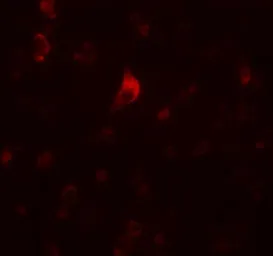 Anti-CALM antibody used in IHC (Paraffin sections) (IHC-P). GTX85213