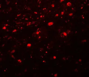Anti-Girdin antibody used in IHC (Paraffin sections) (IHC-P). GTX85215