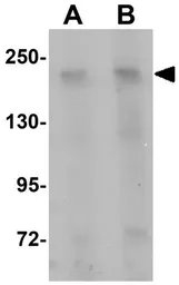 Anti-Girdin antibody used in Western Blot (WB). GTX85215