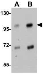 Anti-SLFN14 antibody used in Western Blot (WB). GTX85216