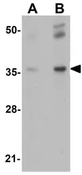 Anti-RHBDD2 antibody used in Western Blot (WB). GTX85219