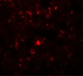 Anti-RHBDD2 antibody used in IHC (Paraffin sections) (IHC-P). GTX85219