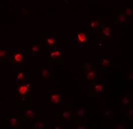 Anti-PPAPDC2 antibody used in Immunocytochemistry/ Immunofluorescence (ICC/IF). GTX85222