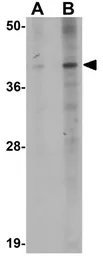 Anti-PPAPDC1B antibody used in Western Blot (WB). GTX85223