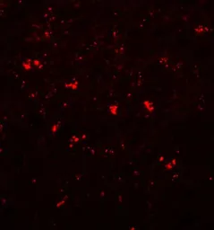 Anti-PPAPDC1A antibody used in IHC (Paraffin sections) (IHC-P). GTX85224