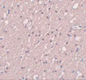 Anti-SIPA1L3 antibody used in IHC (Paraffin sections) (IHC-P). GTX85226