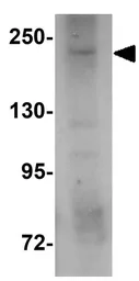 Anti-SIPA1L3 antibody used in Western Blot (WB). GTX85226