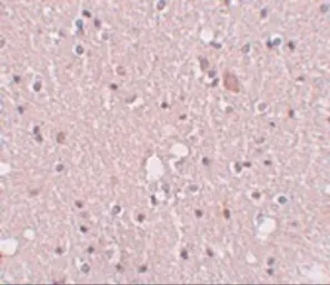 Anti-SIPA1L2 antibody used in IHC (Paraffin sections) (IHC-P). GTX85227