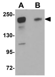Anti-SIPA1L2 antibody used in Western Blot (WB). GTX85227