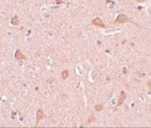 Anti-SIPA1L1 antibody used in IHC (Paraffin sections) (IHC-P). GTX85228