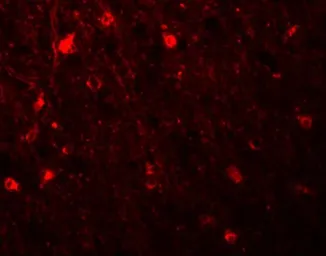 Anti-SIPA1L1 antibody used in IHC (Paraffin sections) (IHC-P). GTX85228