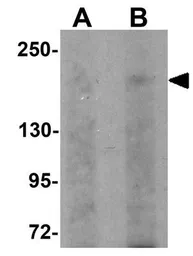 Anti-SIPA1L1 antibody used in Western Blot (WB). GTX85228