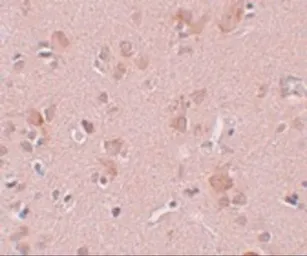 Anti-PLEKHM3 antibody used in IHC (Paraffin sections) (IHC-P). GTX85229