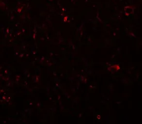 Anti-PLEKHM3 antibody used in IHC (Paraffin sections) (IHC-P). GTX85229