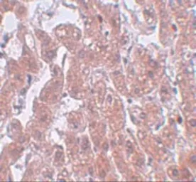 Anti-FAM59A antibody used in IHC (Paraffin sections) (IHC-P). GTX85231