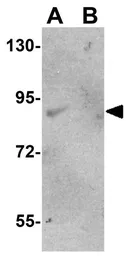 Anti-FAM59A antibody used in Western Blot (WB). GTX85231