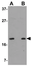 Anti-OCIAD2 antibody used in Western Blot (WB). GTX85232